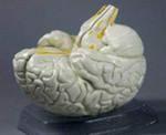 Самый древний сохранившийся мозг